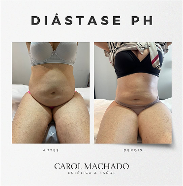 SaveClip.App_449059275_18448237816024840_3446939117752416933_n