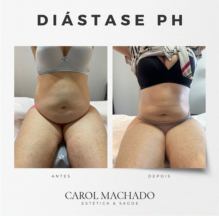 SaveClip.App_449059275_18448237816024840_3446939117752416933_n