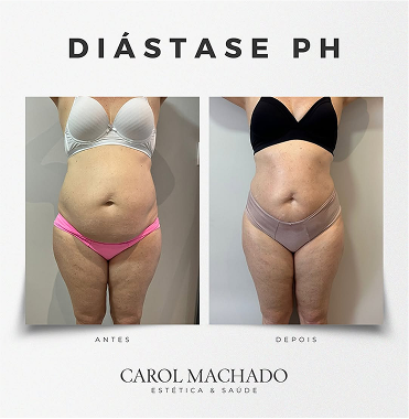 SaveClip.App_449059413_18448237807024840_6396413712798431909_n