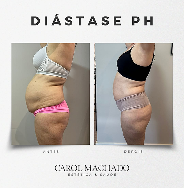 SaveClip.App_449060118_18448237795024840_2171014091759476143_n