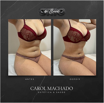 SaveClip.App_472860991_18487145314024840_8850989302005173019_n