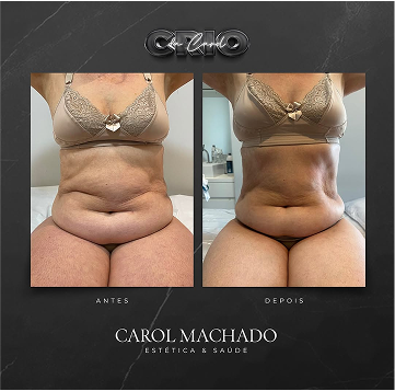 SaveClip.App_473093922_18487310287024840_5441258541114596162_n